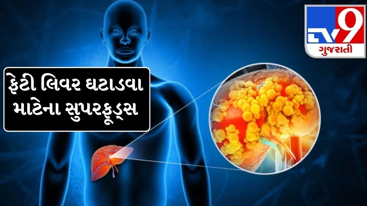 ફેટી લિવર નિયંત્રણમાં રાખવા માટે ડાયટમાં સામેલ કરો આ 5 ખાદ્ય પદાર્થો